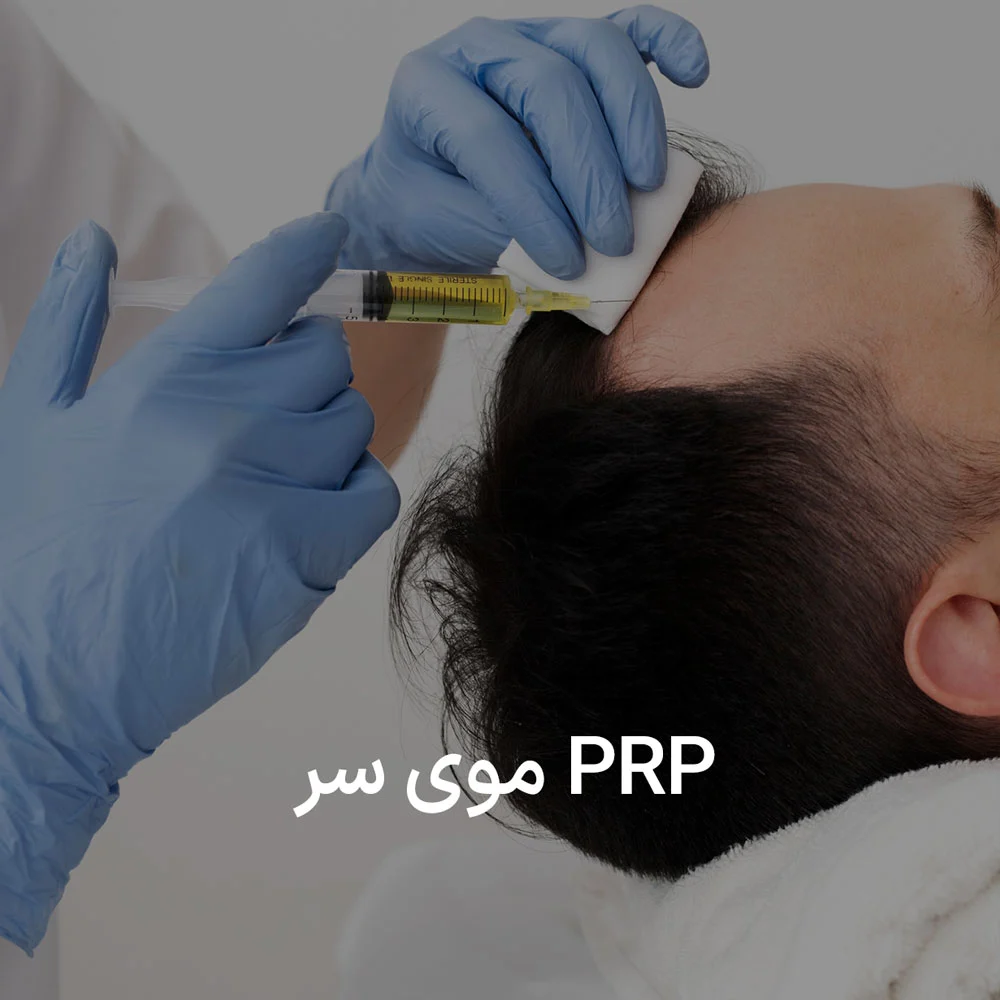 PRP برای سر