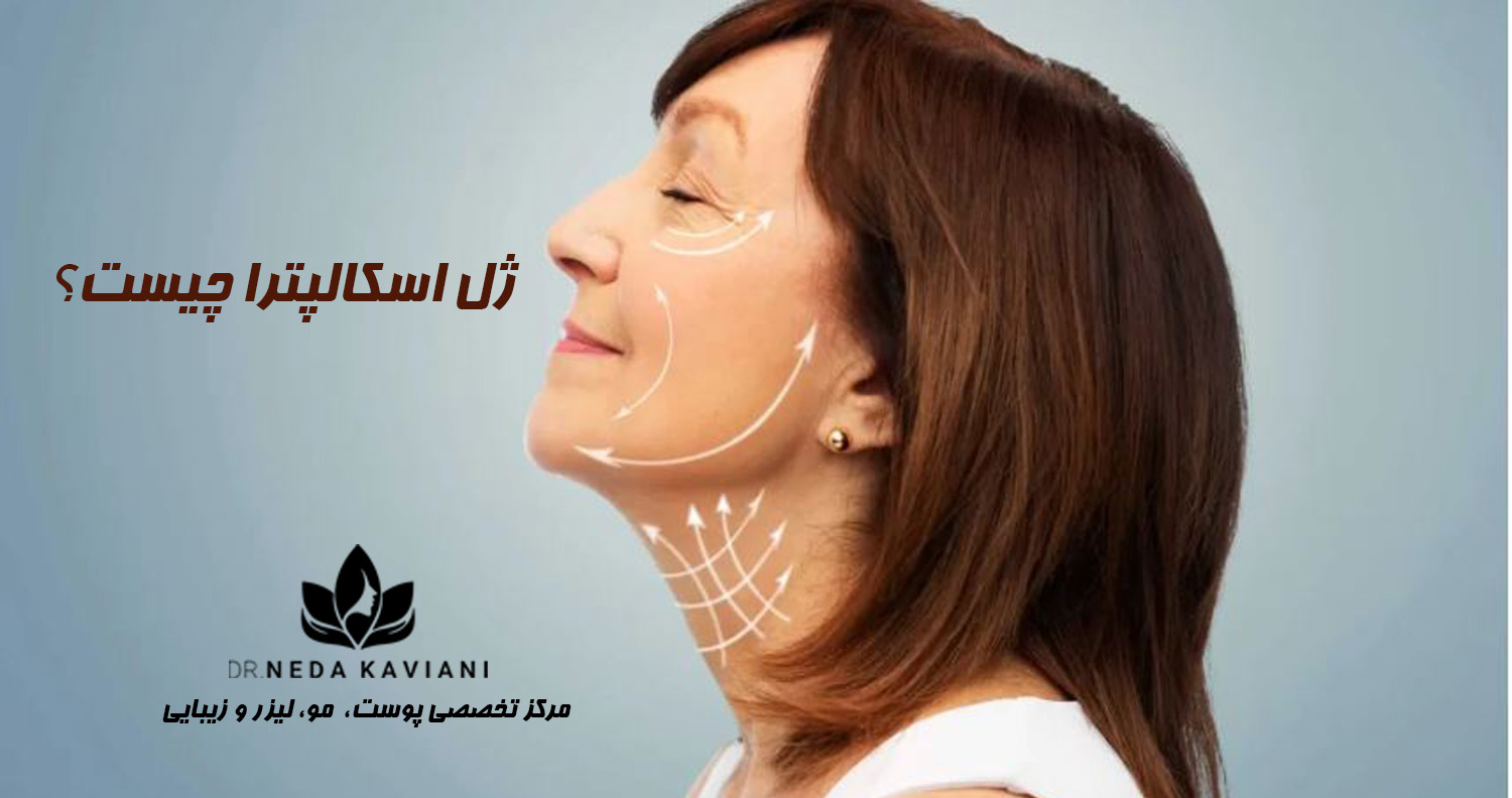 اسکالپترا