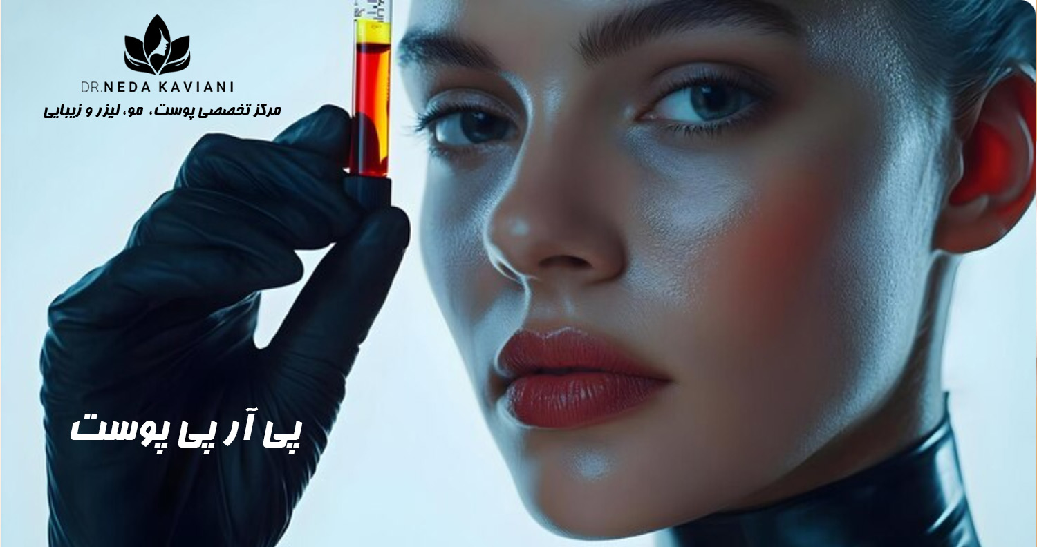 پی آر پی پوست